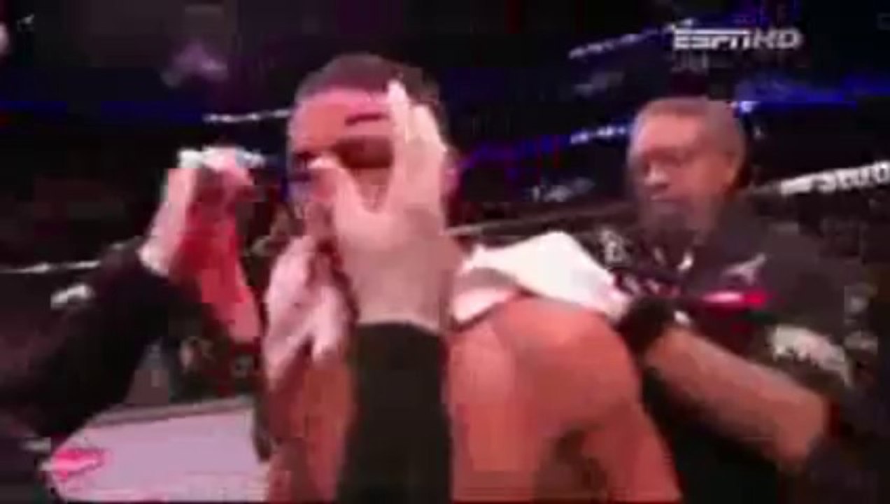 Biggest cut in the UFC with High Kick