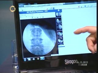 Descubre los beneficios de la Ozonoterapia