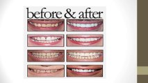Cosmetic Dentist || Cosmetic Dentist NYC || Best Cosmetic Dentist NYC