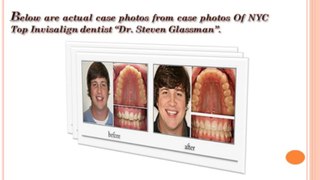 Invisalign Dentist || Top NYC Invisalign Dentist ||  Invisalign