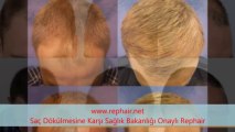 RepHair Saç Dökülmesine Karşı ve Saç Çıkarıcı Sağlık Bakanlığı Onaylı Ürün