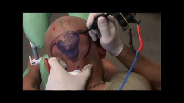 tete de belier sur le crane