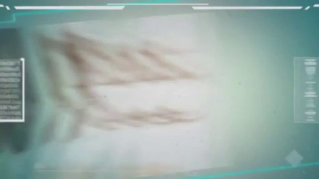 Invisalign Offers For London - Best Invisalign Offers Going