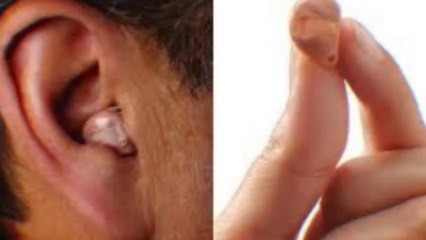 Lyric hearing aid cost