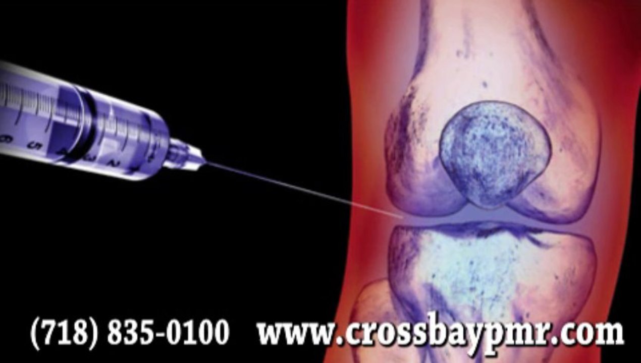 Tratamiento Del Líquido Articular  - Queens NYC, Howard Beach, Ozone Park  - Medicina Regenerativa