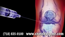 Tratamiento Del Líquido Articular  - Queens NYC, Howard Beach, Ozone Park  - Medicina Regenerativa