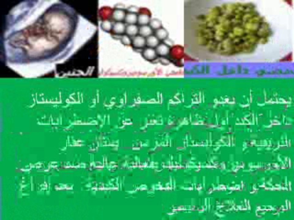 Grossesse et hépatopathies- Foie et grossesse