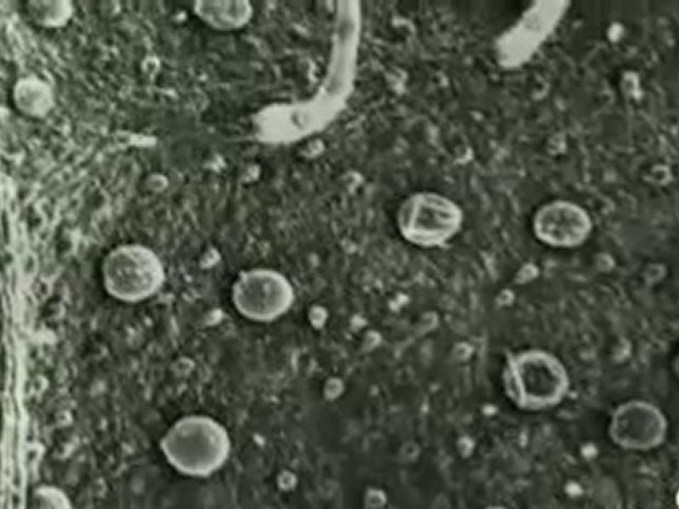 zoom microscope electronique vegetal