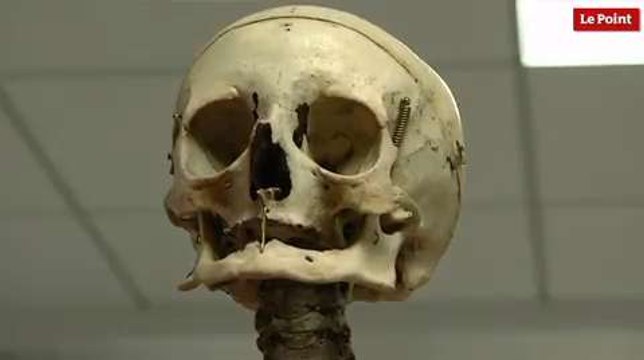 Les incroyables trésors de l’Histoire : le squelette du nain Bébé.
