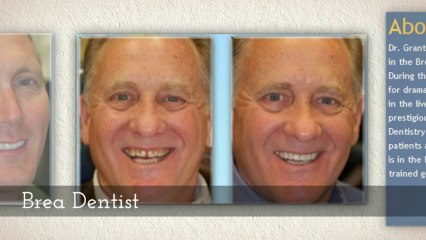 santa ana dentistry - (888) 684-4436 Call Now! Grant A. Burdick, D.D.S. Designed Smiles