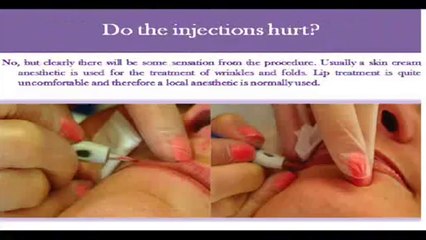 non surgical skin treatment brighton