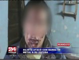 Sujeto agredió brutalmente a su pareja con barra de metal en Huancayo
