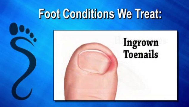 Podiatrist in Memphis, Shelby County and Mid-South TN - Adult and Pediatric Foot Center