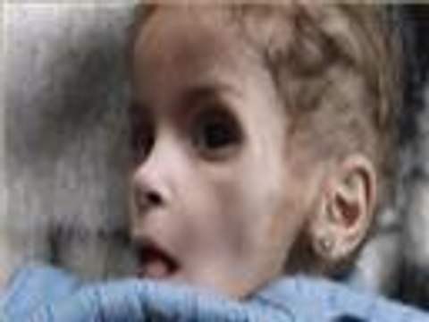 طفلة تموت جوعا بمخيم اليرموك المحاصر