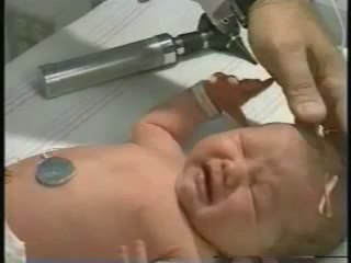 Physical Examination-Full Neonatal Examination.-Part3 - Free
