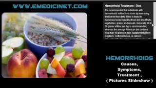 Hemorrhoids Causes, Symptoms, and Treatment - High Quality -1280x720