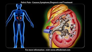 Pelvic Pain Causes, Symptoms,Diagnosis and Treatment -1280x720