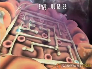 Rayman contre les Lapins Crétins - Un petit mal de tête