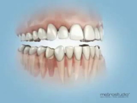 Dentist in Bensonhurst - Eugene Khaytsin DDS - Cosmetic Dentistry