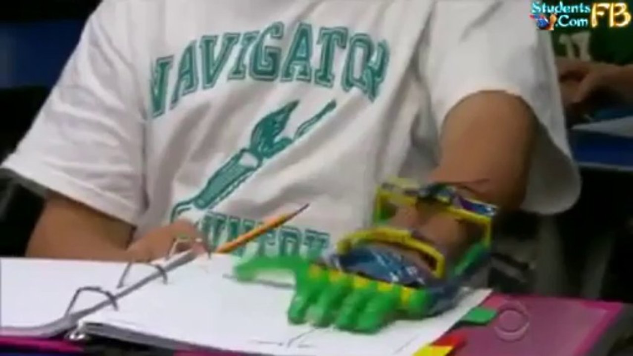 Boy Gets Hand Made By 3D Printer!