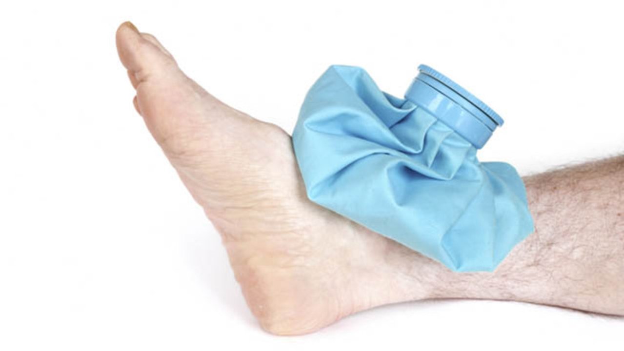 How to treat a sprain
