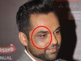 Abhay Deol BEATEN By Music Label - See NOW