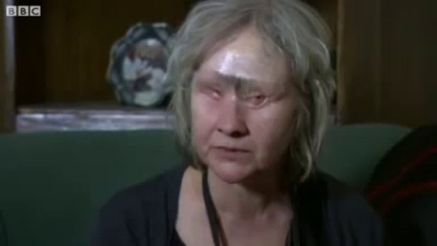 Wendy Hamriding se fait dévorer le visage par son chien