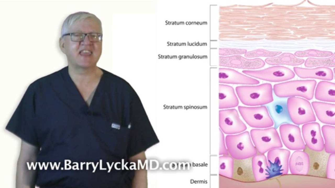 Squamous Cell Skin Cancer explained by Dr Barry Lycka