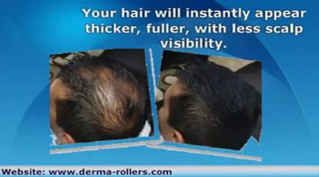 Hair Building Fiber in Pakistan Call 03009533102