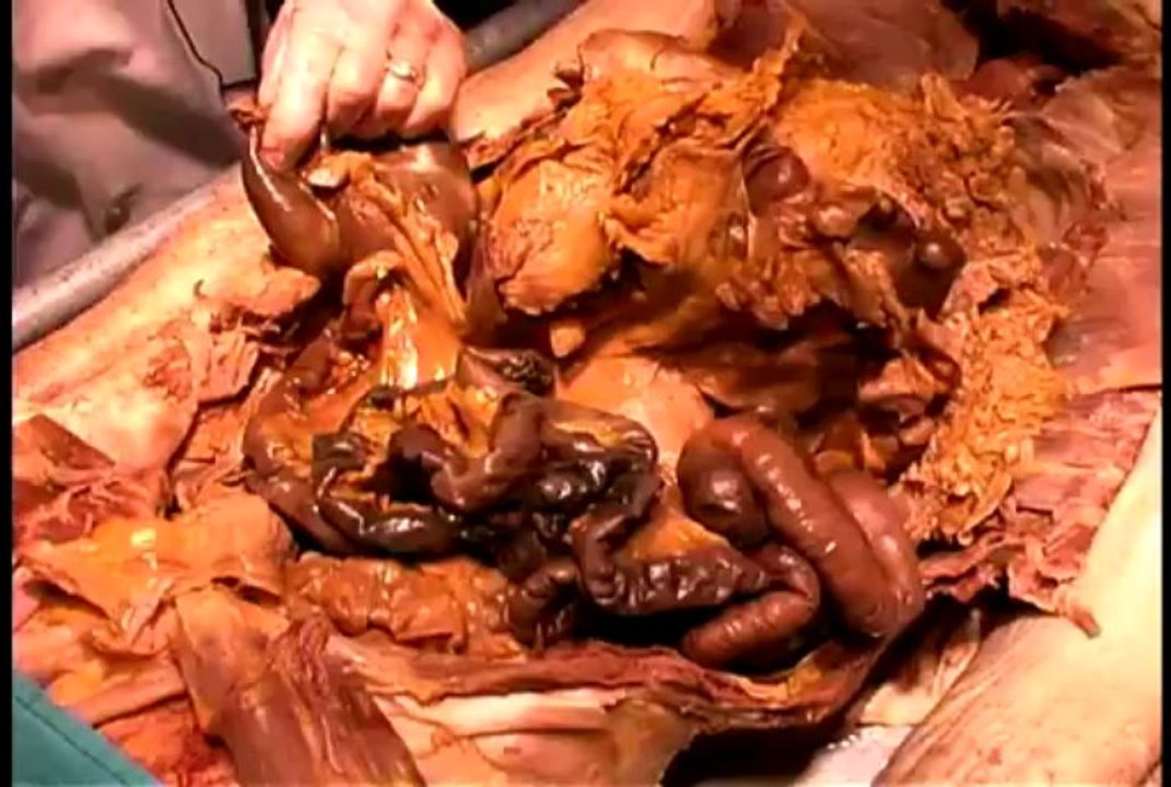 Dissection06