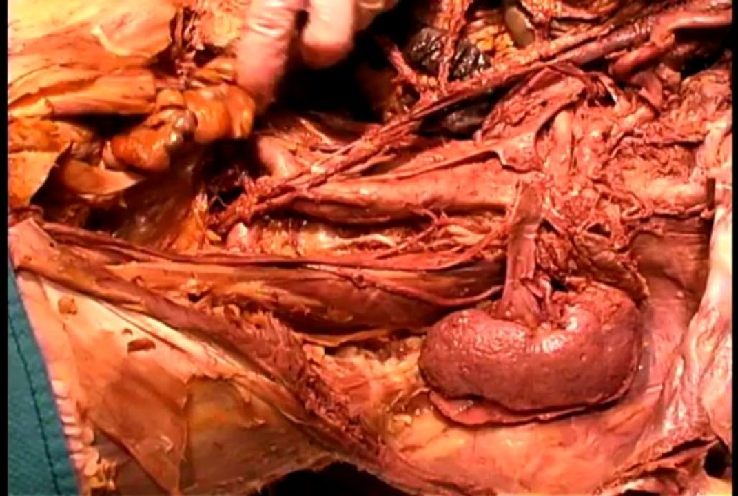 Dissection08