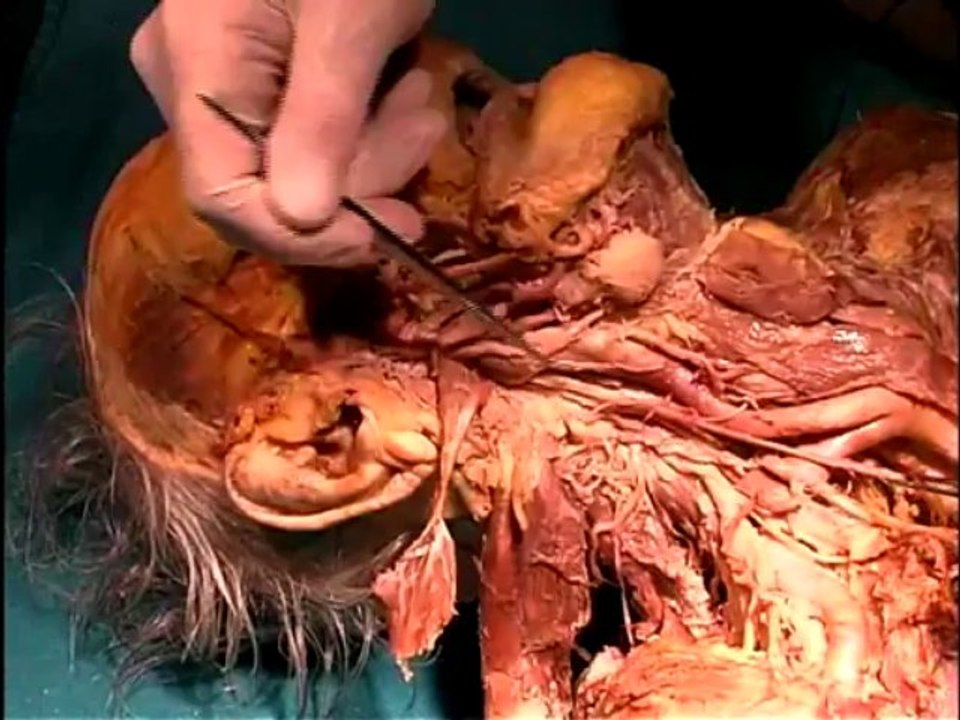 Dissection14