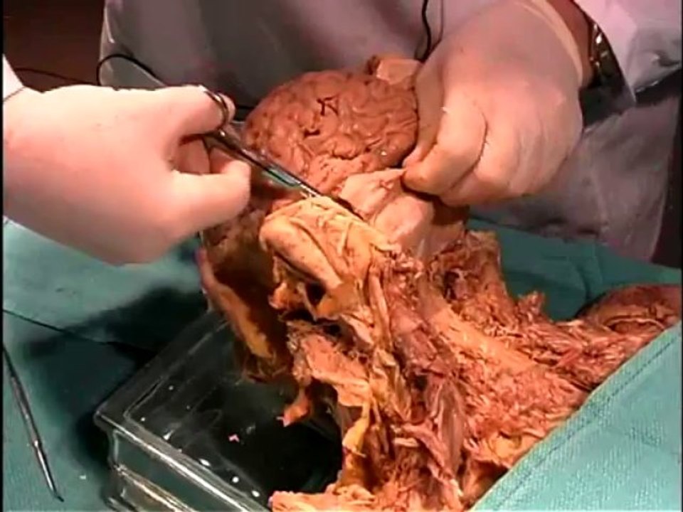 Dissection15