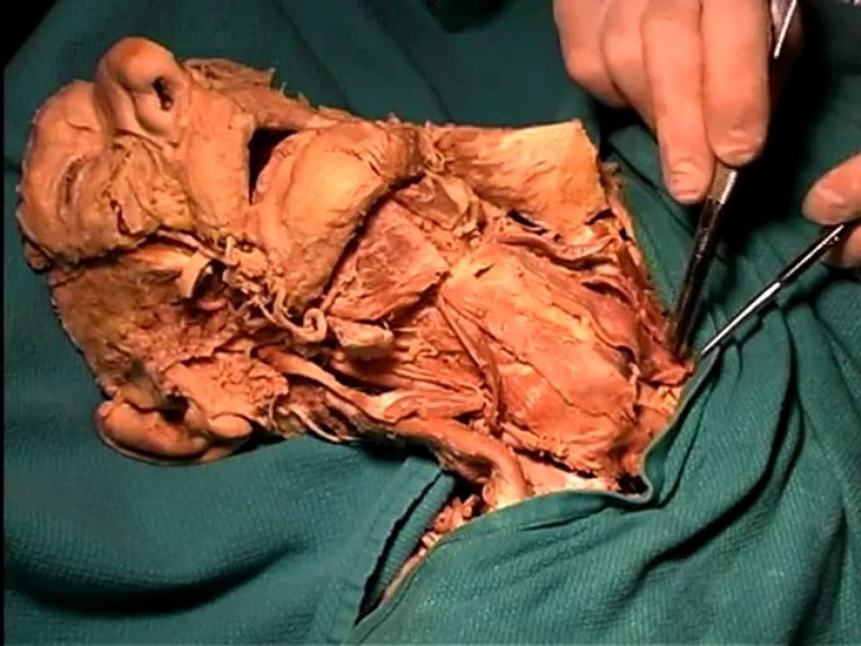 Dissection19