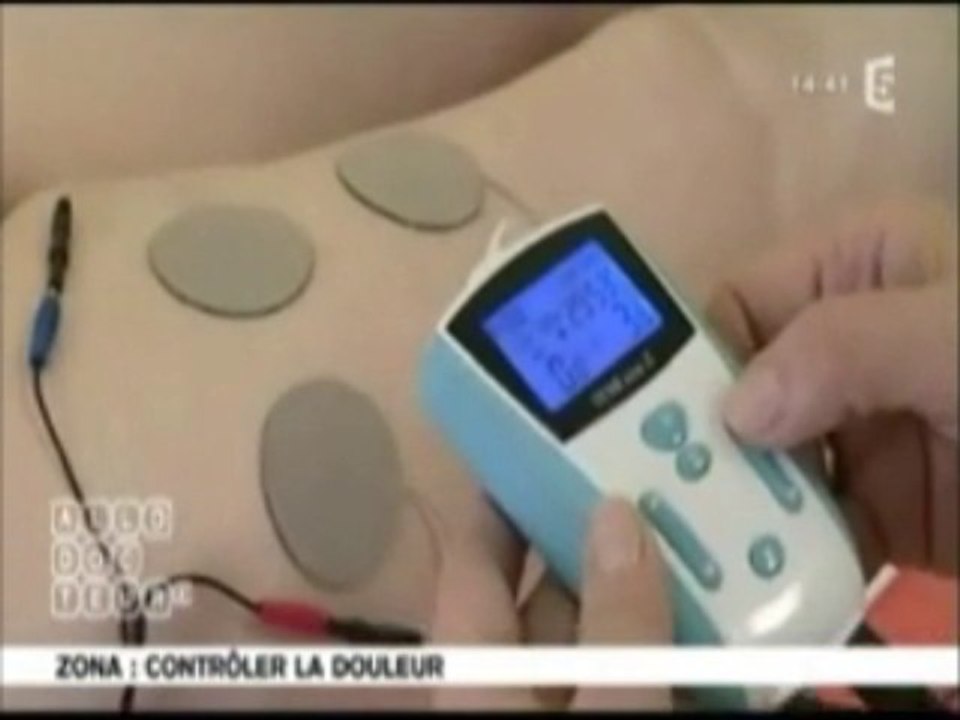 La neurostimulation contre les douleurs du zona, sur France 5