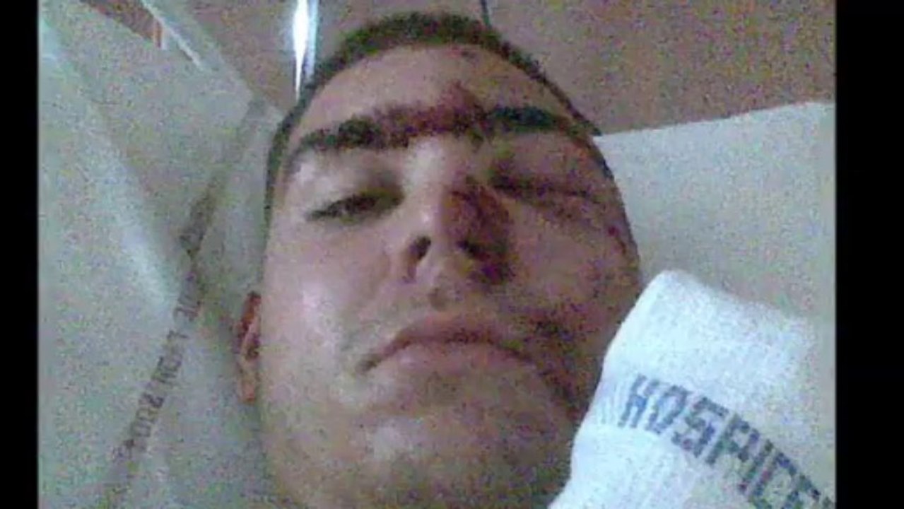 moto accident