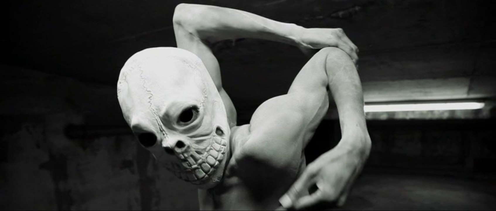 Radikal MC - Allez Leur Dire