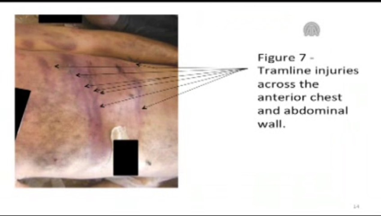 Ey dünya, Suriye'ye sessiz mi kalacağız?