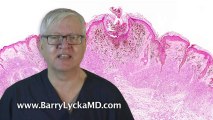 Melanoma Skin Cancer explained by Dr Barry Lycka