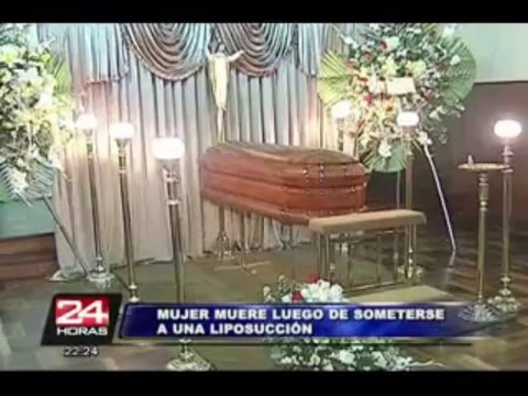 Monterrico: empresaria se somete a liposucción y muere por negligencia médica