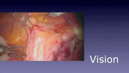 Catherine Mohr_ Surgery's past, present and robotic future