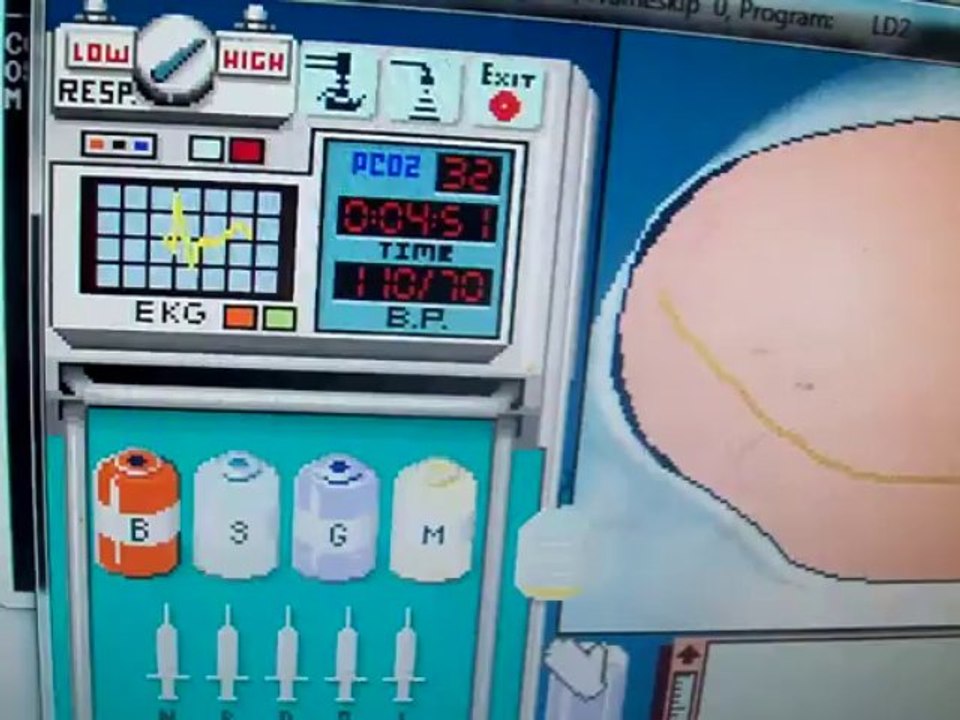 Phony ad for Bennett and McKnight:  Renal Shock