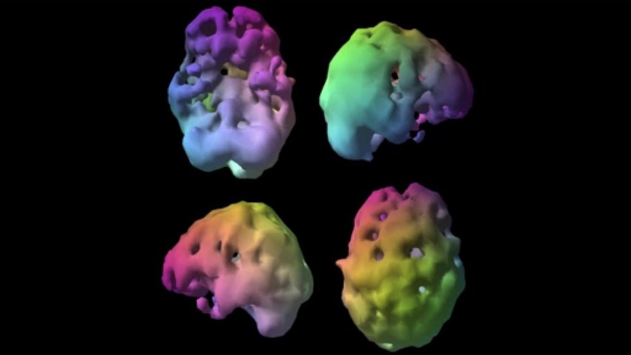 Spect Imaging and Plea Bargaining Strategy