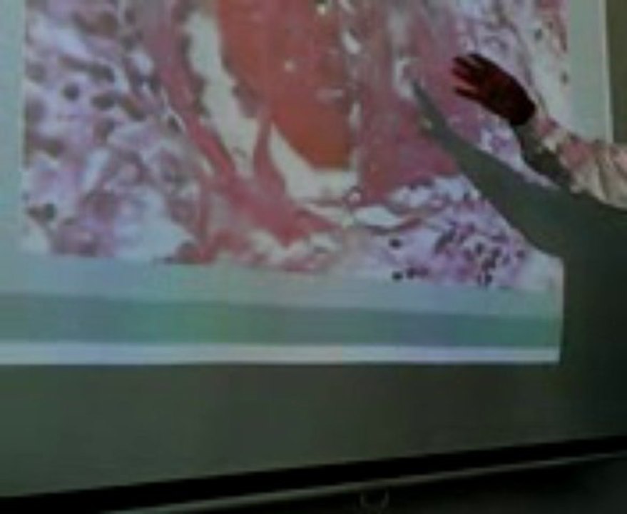 Cell Degenerations Part 1: Lecture by Dr. Ahmad Din Anjum