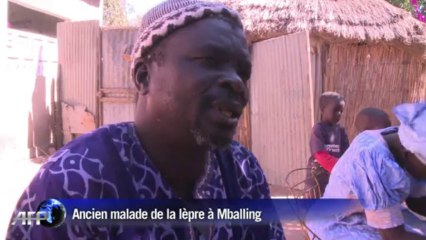 Sénégal: la lèpre continue de mutiler et d'exclure