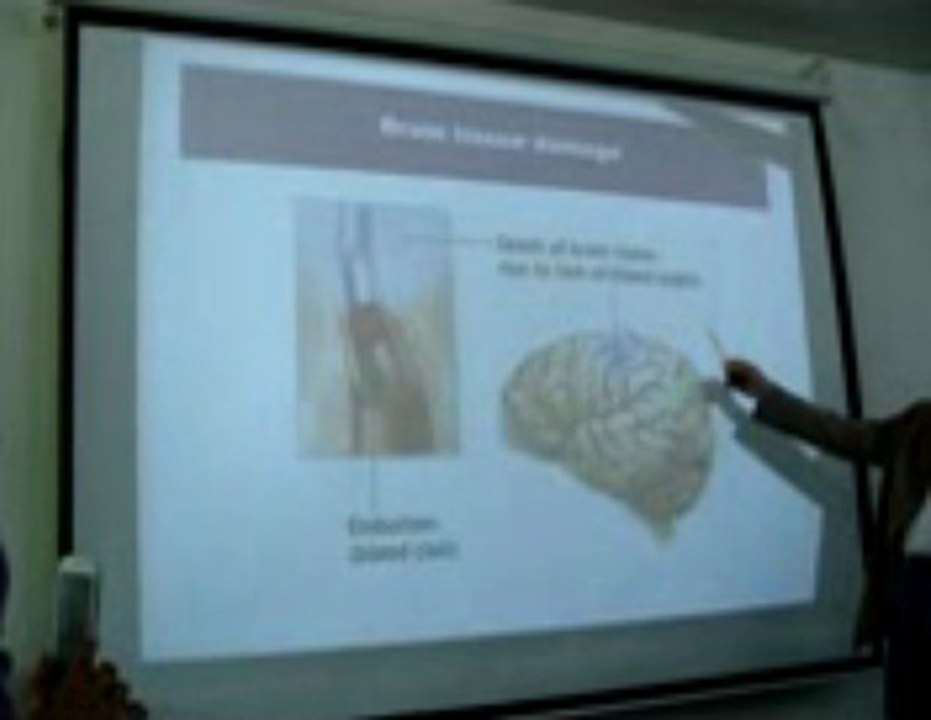 Embolism Part 2: Lecture by Dr. Ahmad Din Anjum (Pathology)