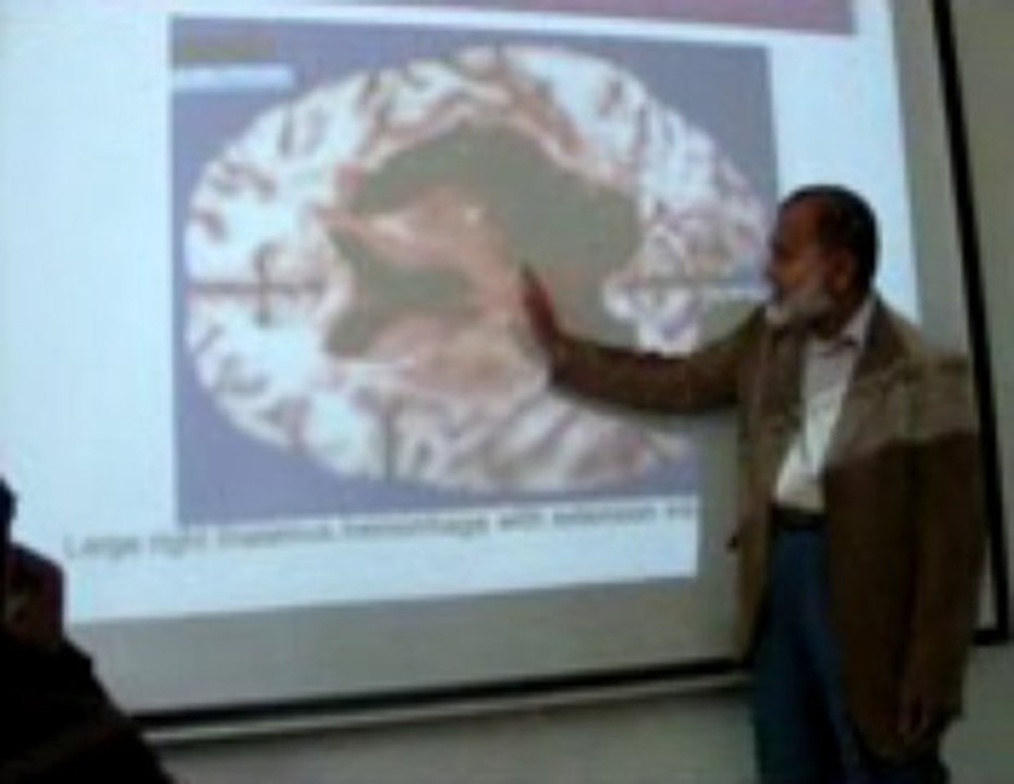 Infarction Part 1: Lecture by Dr. Ahmad Din Anjum (Pathology)