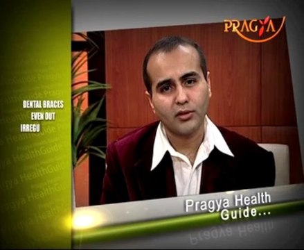 Dental braces are a type of orthodontic treatment used to correct teeth