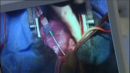 "Chaîne de l'espoir" : une famille pour un nouveau coeur