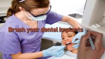 5 Things that You Should Know before Getting Dental Implants_Los Gatos, CA 95032